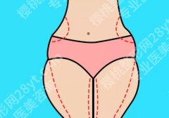 北京协和吸脂手术多少钱啊？1-8万元，价格明细、口碑、医生等重点解析