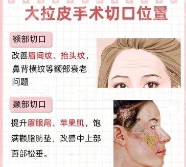 安徽省立医院除皱价格贵不贵？核心项目及技术优势点评！