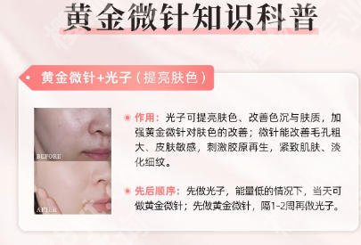 北医三院黄金微针价格公布！明细公开！无隐形消费