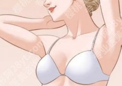 西京医院自体脂肪填充隆胸丰胸多少钱？1.8万元起，一文讲述更多重点