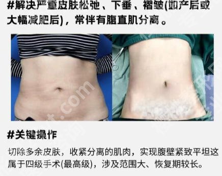 西京医院吸脂价目表更新！附面诊技巧-医生名单