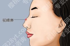 嘉兴哪个整形医院鼻修复好？5家正规好院实测，连锁私立+公立医院全汇总
