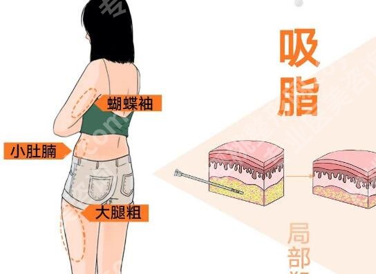 吉大二院去眼袋多少钱？去眼袋价格为5673元起