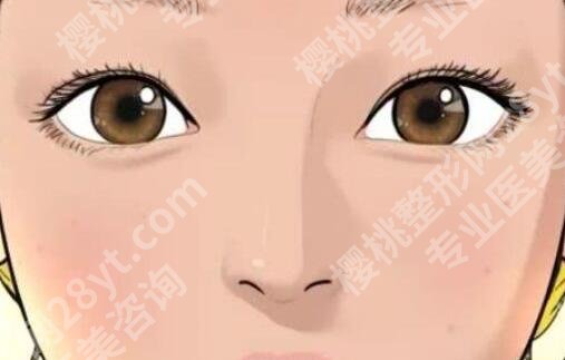 上海第二人民医院割双眼皮多少钱？11213元起，术前提前看