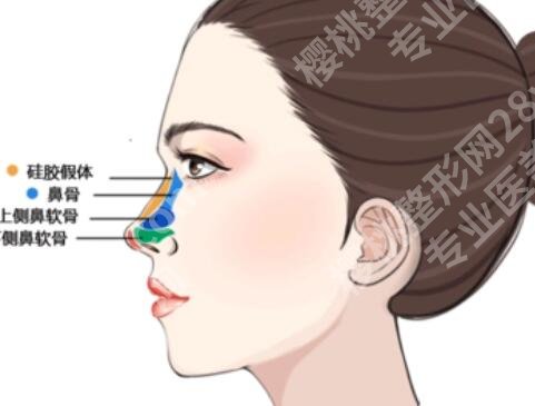 南通做鼻子比较出名的医生盘点~哪位大白技术好？一起来看看