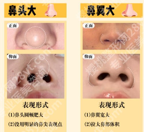 湖州做鼻子好的医生排名榜单公布！卢建锋、冯文、张文显等医生实力上榜！