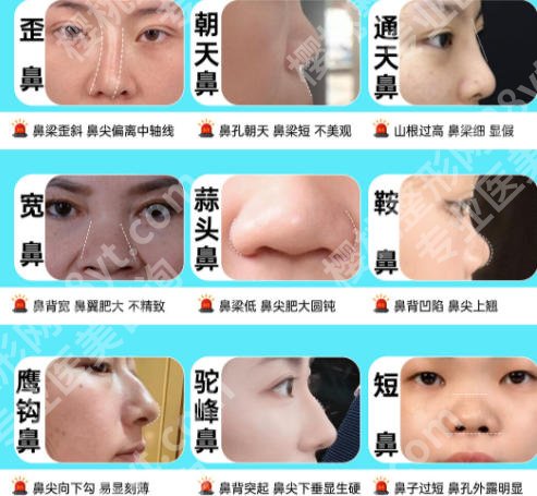 西安隆鼻专家排名榜单公布!李学拥、柏宏亮等医生实力派更新!