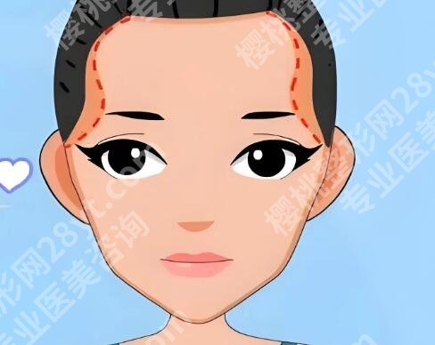 华西医院脂肪填充多少钱？填充8000元起，医院资料全公开
