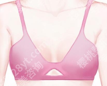 上海第二人民医院假体隆胸价格多少？假体隆胸22800元气，2026价格在线看