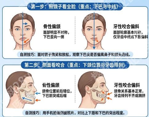 上海偏颌整形医院排名榜单强势来袭!这五家医院口碑、技术都值得信赖!
