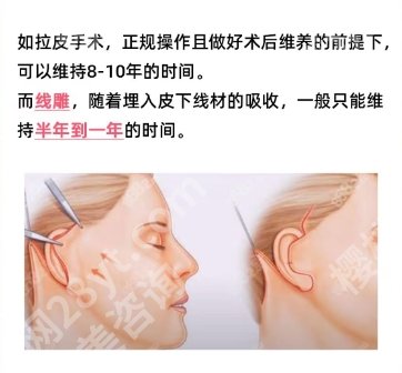 深圳抗衰哪个整形医院比价好？艺星高飞、美莱刘浩通通上榜！