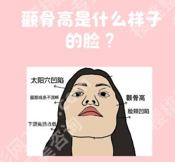 广州磨骨出名的专家：韩妃柳超、南方医院杜本军、人医王原路实力强！