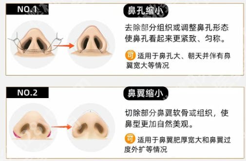 厦门隆鼻医生排名测评!殷佳鹏、卢艺朴等医生口碑实力详解速看!
