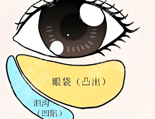 北京301医院去眼袋需要多少钱?6713元起,来看看医院实力