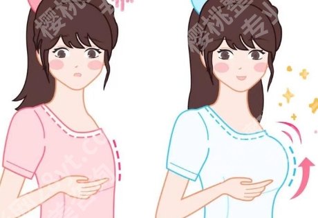 成都华西隆胸哪个医生好？资历和案例能说明问题