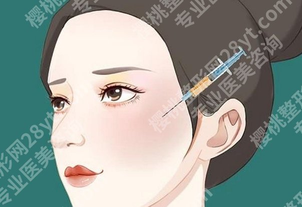 南方医院脂肪填充怎么样？适合部位、维持特点与恢复节奏讲明白
