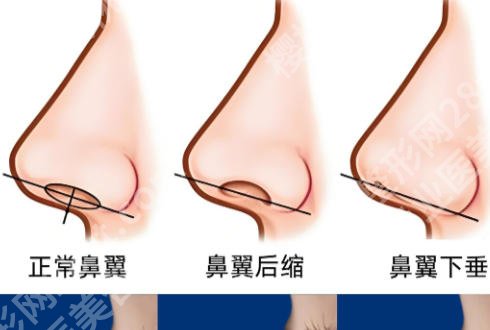 天津鼻修复比较好的医院比较好的医院有哪些?2026天津口碑医院排名!