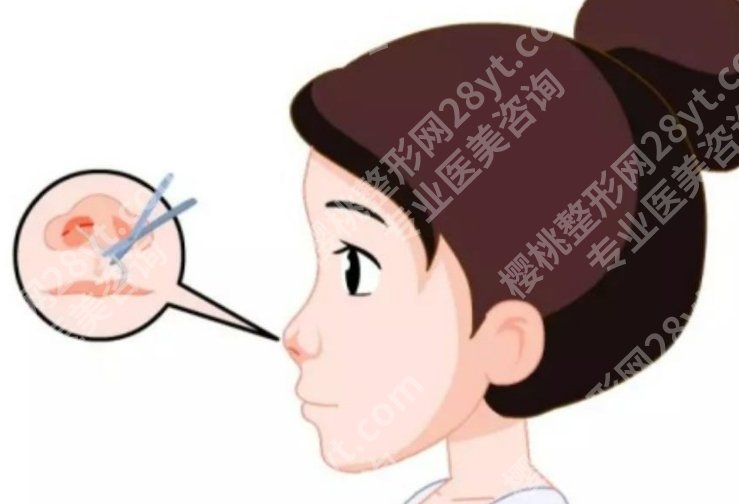 华西做隆鼻怎么样?团队经验与设计理念盘点