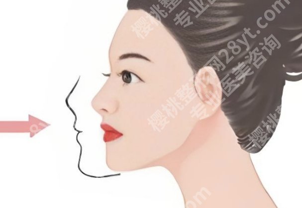 深圳北大医院正颌怎么样?技术特点与经验背景介绍