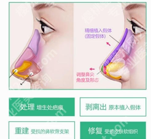 中山鼻修复比较出名的医生(专家)!严选前五医生评价一览!