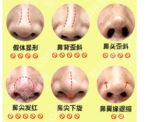 兰州鼻修复比较好的医院有哪些？五家医院通通上榜！