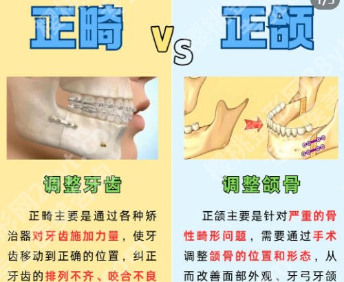 北京做正颌排名的医院有哪些?五家医院实力上榜!