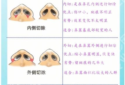 湖州隆鼻哪个医生好？前五医生名单信息展出！