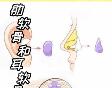 北京肋骨鼻前十名医生!尤建军、薛红宇、安阳等医生实力上榜!