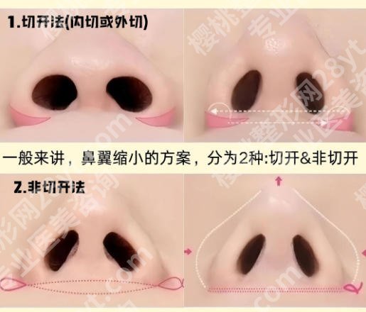 宁波隆鼻十大医院排行榜单强势来袭!(口碑top10)实力颇为关注!