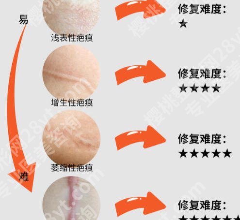 安阳祛疤医院有哪些？汇总单前五强口碑,价格一探虚实！