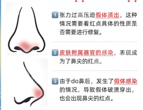 临沂鼻修复医院排名前三！，附医院详情排名排行名单及2026新价格表一览！
