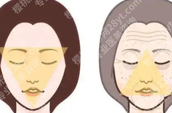 脂肪填充成都哪家做得好？看案例风格和面诊思路更关键