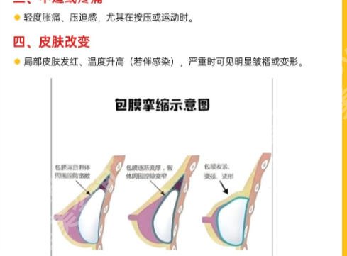 北京乳房整形医院排名前十排行榜单发布!TOP10优势、交互展示!