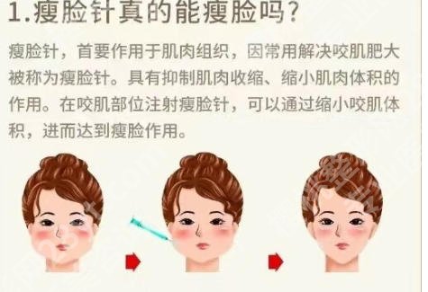 海口打瘦脸针哪家医院好？这些宝藏医院别错过！