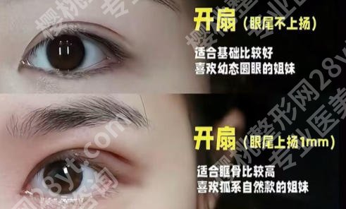 上海眼整形哪个医院好?口碑技术有保障,资料抢先看!