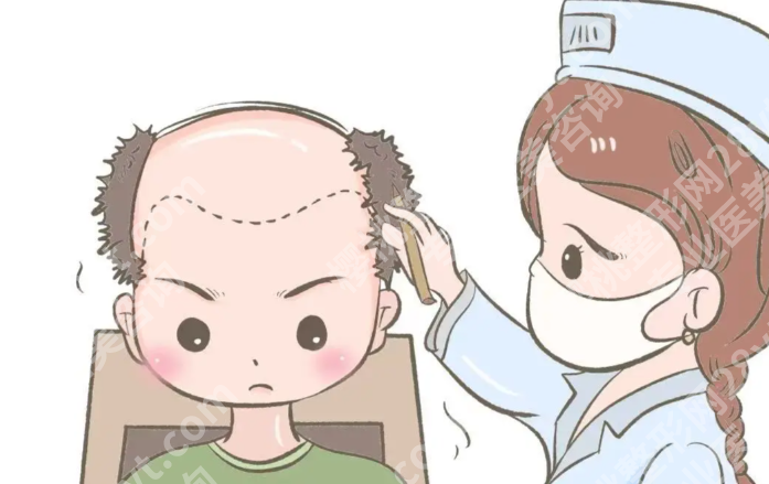 长春种植头发哪家医院好?发友真实反馈+植发技术对比