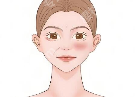 九院吸脂有失败的么?真实情况+避坑指南全揭秘