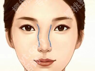 天津鼻修复专家前十名如何?10位大佬盘点,避坑不踩雷