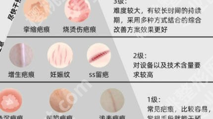 徐州除疤医院哪家好?排名前五名单及专业点评!