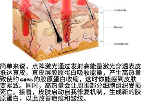 邯郸点阵激光医院哪个好?实力排名榜单出炉!