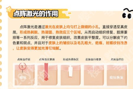 湖州哪个医院可以做点阵激光?正规三甲深度盘点!