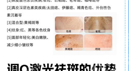 南昌激光祛斑一般需要多少费用一次?排行榜前三医院有实力