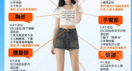 北京华韩吸脂怎么样？来看真实案例和费用！