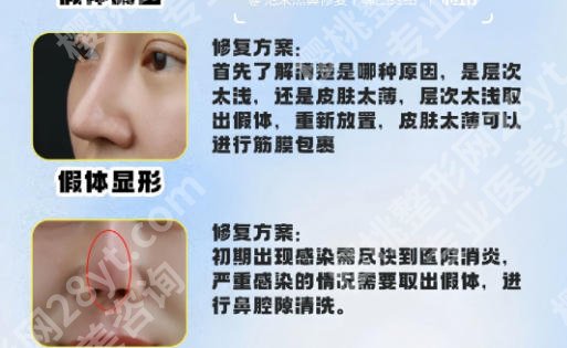 青岛鼻修复比较出名的医生(专家)有哪些?陈振雨、柯家祥等5位实力来袭