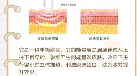 上海做热玛吉好的医院有哪些?上海第九医院、上海艺星实力上榜!