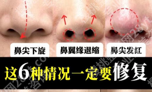 长春鼻修复比较好的医院有什么？榜单前五实力揭晓及排名全解析！