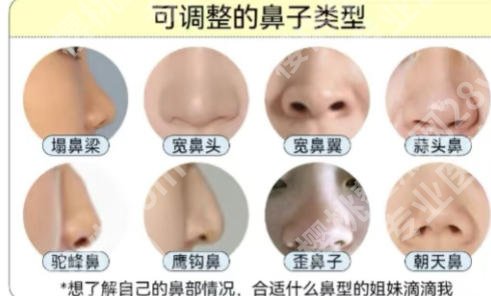 贵阳隆鼻哪家医院好?贵州医科大学附属医院、贵州省人民医院等口碑机构领衔!
