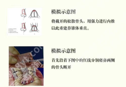 兰州鼻修复哪家医院好?公立三甲与口碑专科机构深度对比!