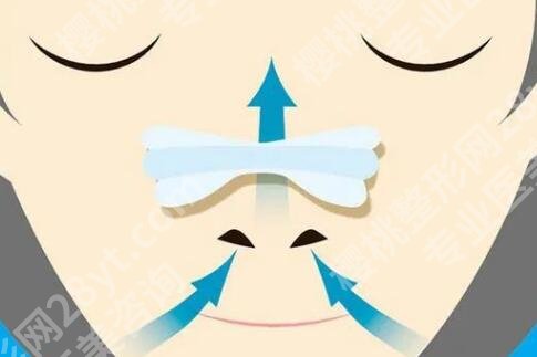 柳州鼻修复医院排名哪个好？5家正规机构闭眼冲，避坑不花冤枉钱