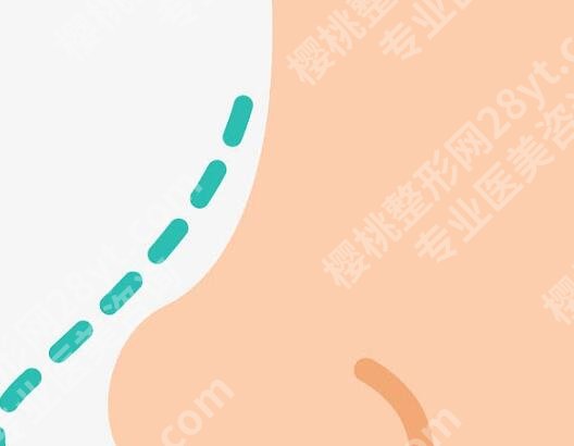 深圳做鼻子好的医生有哪些?这五位大白实力个个顶